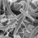 ¿Cómo usted dice nemátodo o nematodo?