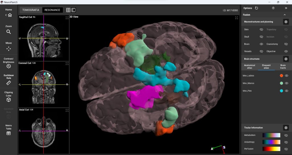 El sistema permite asignar escalas de colores a las áreas elocuentes como movimientos de manos, pies y labios (FOTO: CAPTURA DE PANTALLA DEL SOFTWARE)
